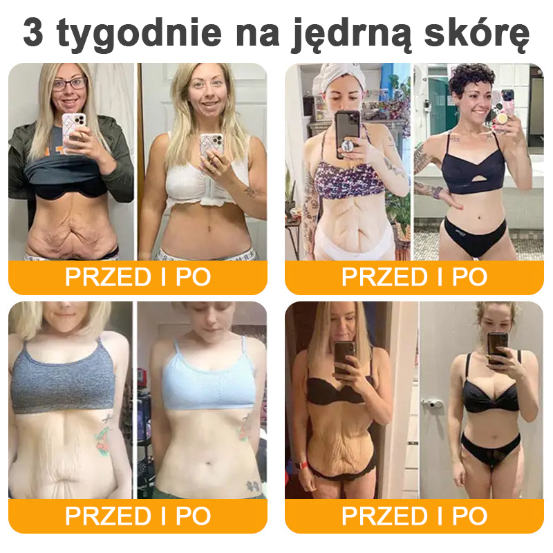 VLSVLS® Krem z jadem pszczelim do regeneracji skóry (👨⚕ odpowiedni dla wszystkich grup wiekowych, polecany przez AAD) 💎