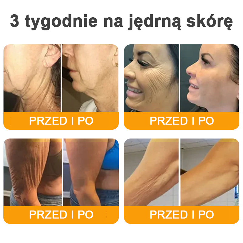 VLSVLS® Krem z jadem pszczelim do regeneracji skóry (👨⚕ odpowiedni dla wszystkich grup wiekowych, polecany przez AAD) 💎