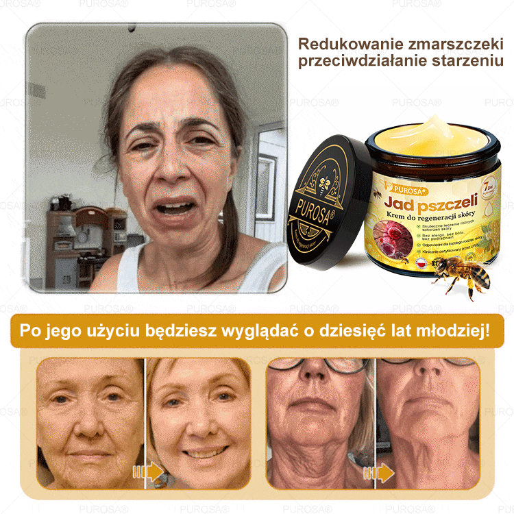 🌟PUROSA® Krem z Jadem Pszczelim do Regeneracji Skóry🐝|Kompleksowe rozwiązanie na uporczywe problemy skórne, takie jak starzenie się, egzema, blizny i łuszczyca
