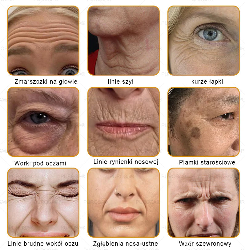 🌟PUROSA® Krem z Jadem Pszczelim do Regeneracji Skóry🐝|Kompleksowe rozwiązanie na uporczywe problemy skórne, takie jak starzenie się, egzema, blizny i łuszczyca