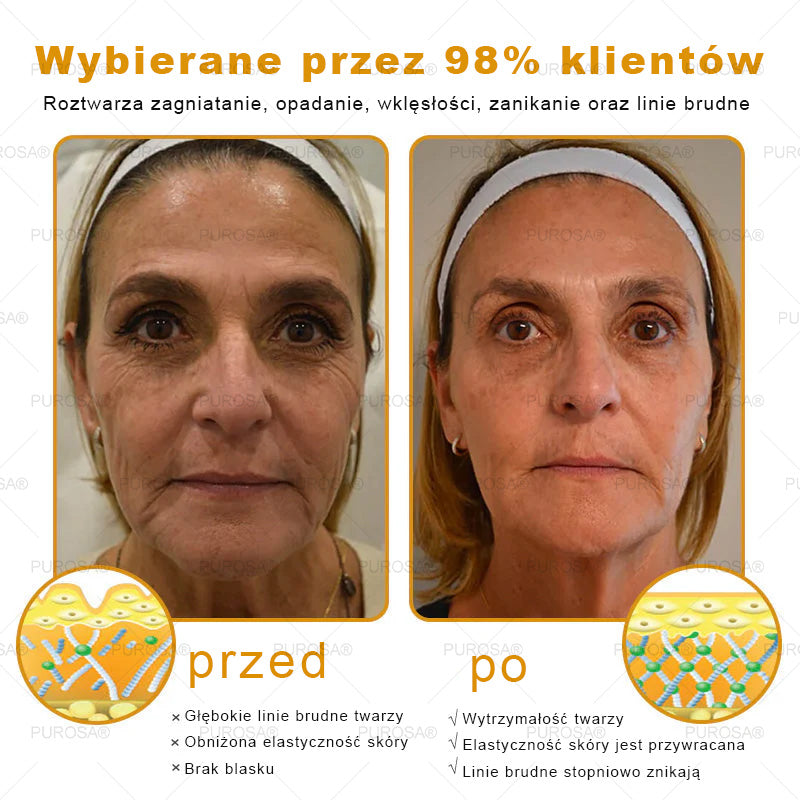 🌟PUROSA® Krem z Jadem Pszczelim do Regeneracji Skóry🐝|Kompleksowe rozwiązanie na uporczywe problemy skórne, takie jak starzenie się, egzema, blizny i łuszczyca