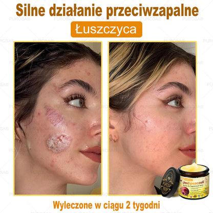 💎PUROSA® Krem z Jadem Pszczelim do Regeneracji Skóry🐝｜Kompleksowe rozwiązanie na uporczywe problemy skórne, takie jak starzenie się, egzema, blizny i łuszczyca