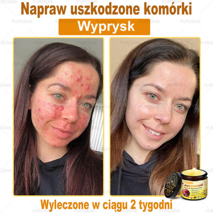 💎PUROSA® Krem z Jadem Pszczelim do Regeneracji Skóry🐝｜Kompleksowe rozwiązanie na uporczywe problemy skórne, takie jak starzenie się, egzema, blizny i łuszczyca