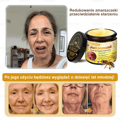 💎PUROSA® Krem z Jadem Pszczelim do Regeneracji Skóry🐝｜Kompleksowe rozwiązanie na uporczywe problemy skórne, takie jak starzenie się, egzema, blizny i łuszczyca