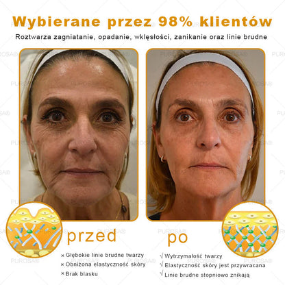 💎PUROSA® Krem z Jadem Pszczelim do Regeneracji Skóry🐝｜Kompleksowe rozwiązanie na uporczywe problemy skórne, takie jak starzenie się, egzema, blizny i łuszczyca